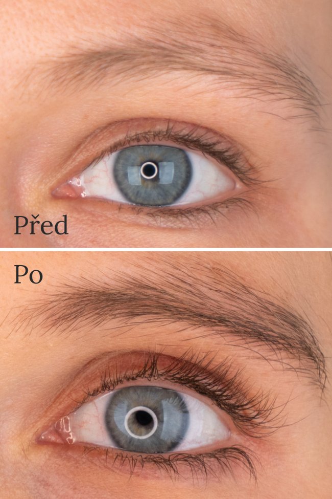 Soutěž o přírodní sérum na podporu růstu řas deNatura